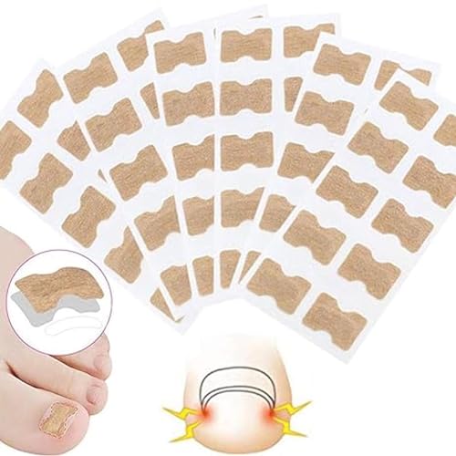 Toenail Correction Stickers - Effective Ingrown Toenail Prevention for Toenail Health 100pcs, Pack of 2