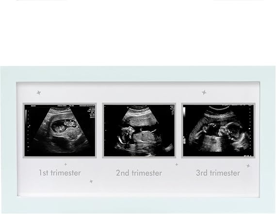 Ultrasound Picture Frame - Triple Sonogram Frame for Mom to Be | Pregnancy Photo Album Decor | Baby Nursery Essentials & Gender Reveal Gifts | First Trimester Keepsake & Pregnancy Must Haves - White1