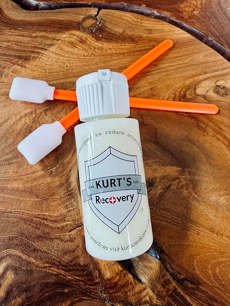 Kurt's Card Care Recovery